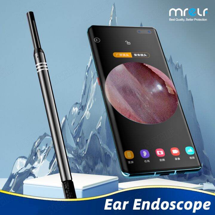 【CW】 Ear Endoscope Clean Your Ears Cleaning the Cleaner Usb Android