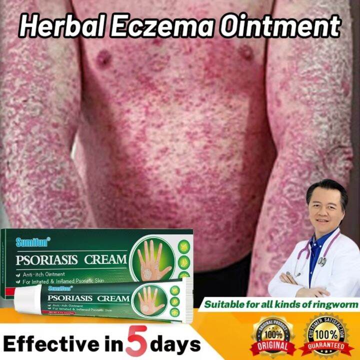 Psoriasis Cream 20g Anti Fungal Herbal Psoriasis Dermatitis Eczema