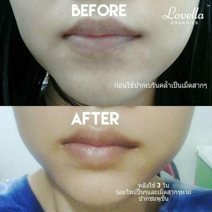 lovella-organics-yuzu-sorbet-lip-treatment-ลิปกลิ่นหอม-ลิปมัน-ลิปบำรุง-กลิ่นส้ม-yuzu-จากญี่ปุ่น-ลิปบำรุง-ชุ่มชื้น-5g