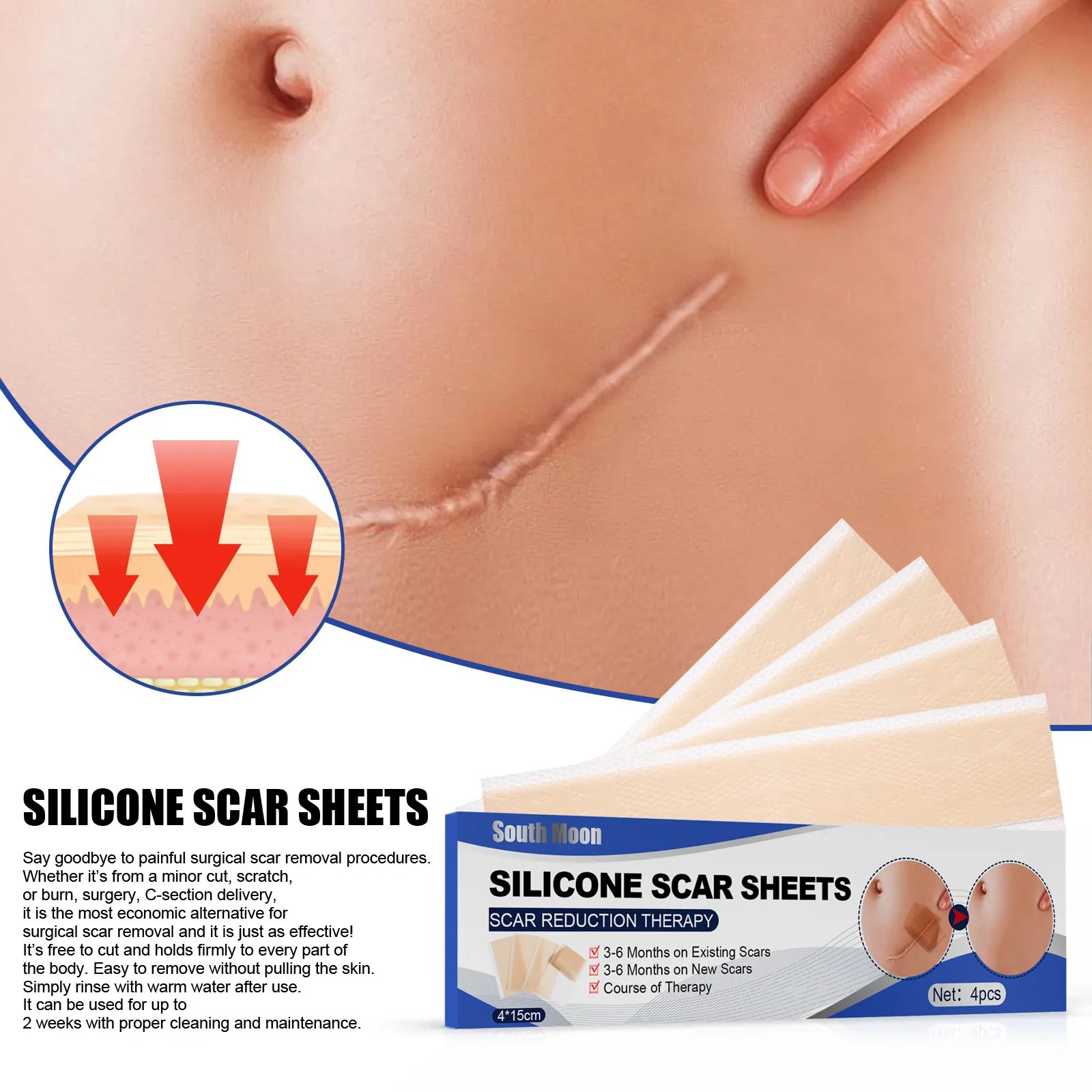 South Moon Scar Removal Sticker Professional Scar Removal Sticker  Flattening Injuries Burns  Caesarean Section Scar Self-adhesive Patch |  Lazada PH