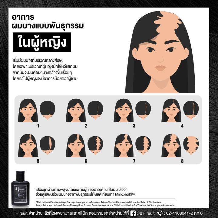 hirsuit-hair-serum-45ml-เซรั่มบำรุงผม-ลดผมร่วง-กระตุ้นการงอก-ลดความมัน-บำรุงรากผม-ปลูกผมเข้มข้นขึ้น-2-เท่า