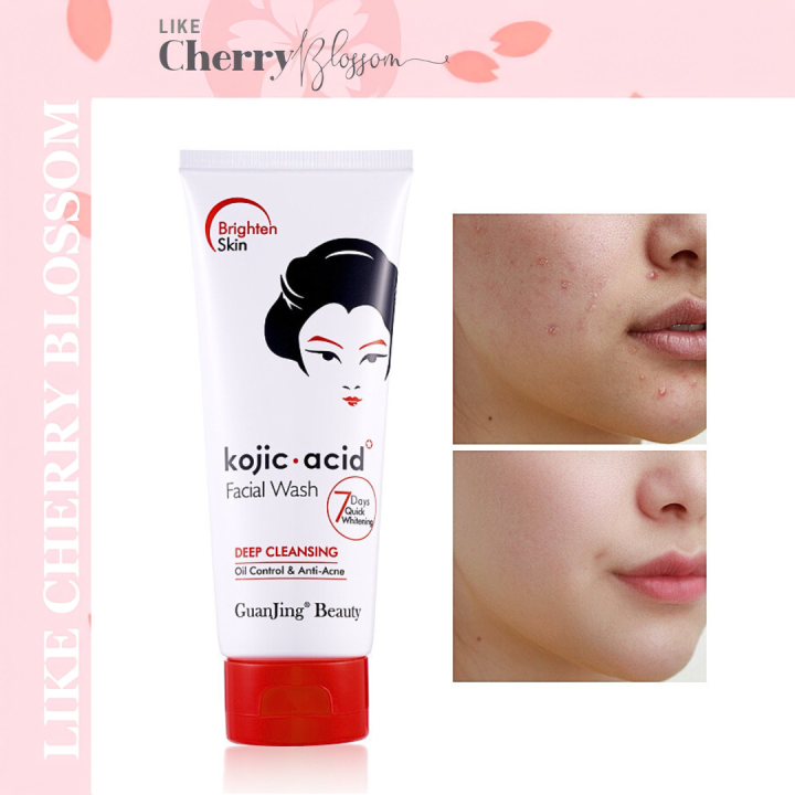 Kojicacid Facial Wash Deep Cleansing Oil Control and AntiAcne