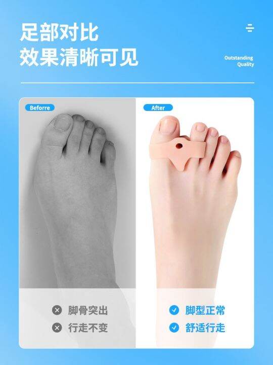 japan-silicone-big-toe-hallux-valgus-orthotics-correcting-big-toe-bone-correction-for-men-and-women-wearable-shoes-day-and-night