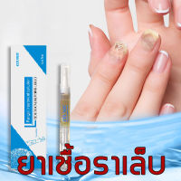 EELHOE Nail Repair Essence Serum เซรั่มซ่อมแซมเล็บ ของแท้100%   บำรุงเล็บ ต่อต้านการติตเชื้อรา ซ่อมแซมเล็บแตก เล็บเปราะ เล็บหนา  ครีมบำรุงเล็บ  เซรั่มเล็บ สําหรับดูแลเล็บ 3ml