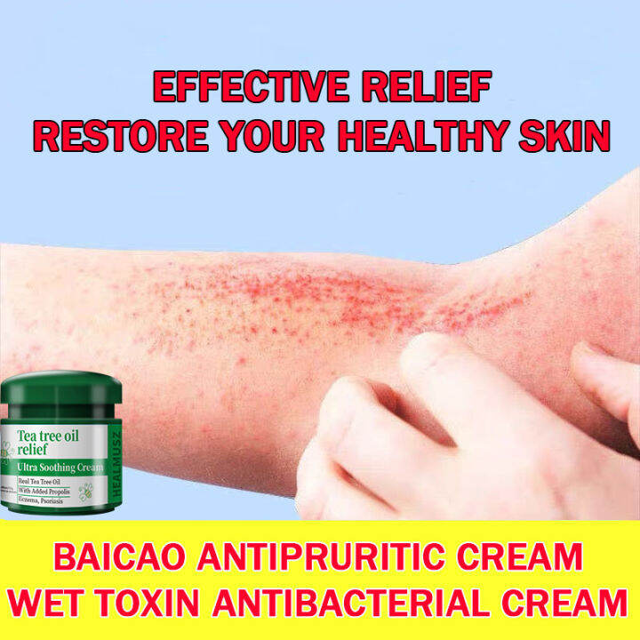 【Quality Shop】 Mosquito bites and antipruritic ointment, suitable for