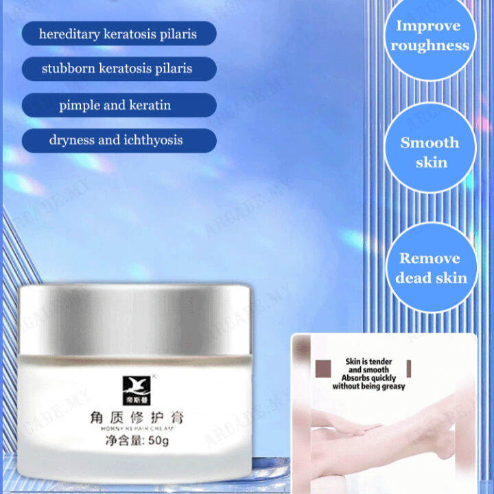 arcade Moisturizing Lotion for Chicken Skin and Rough Skin Bumps Lazada