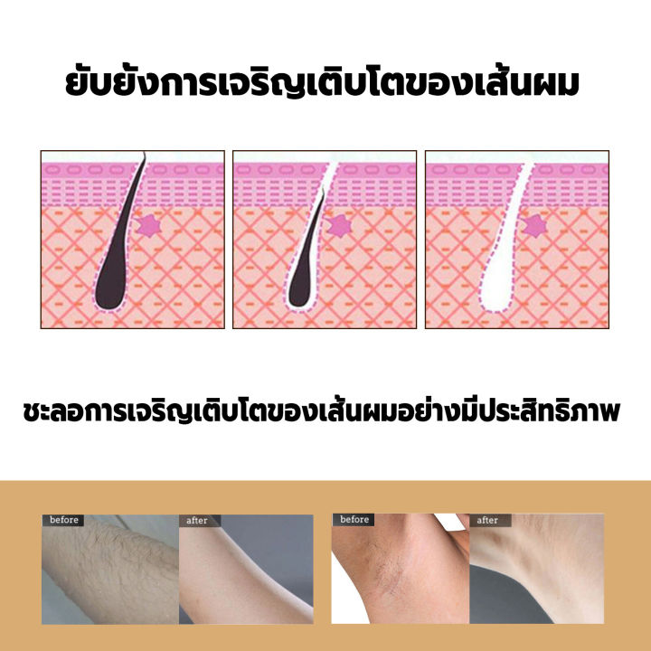 พร้อมส่ง-ครีมกำจัดขนริมฝีปาก-สารสกัดจากธรรมชาติไม่ระคายเคือง-กำจัดขนใบหน้า-กำจัดขนหน้า-ครีมกำจัดหนวด-กำจัดขนบนหน้า