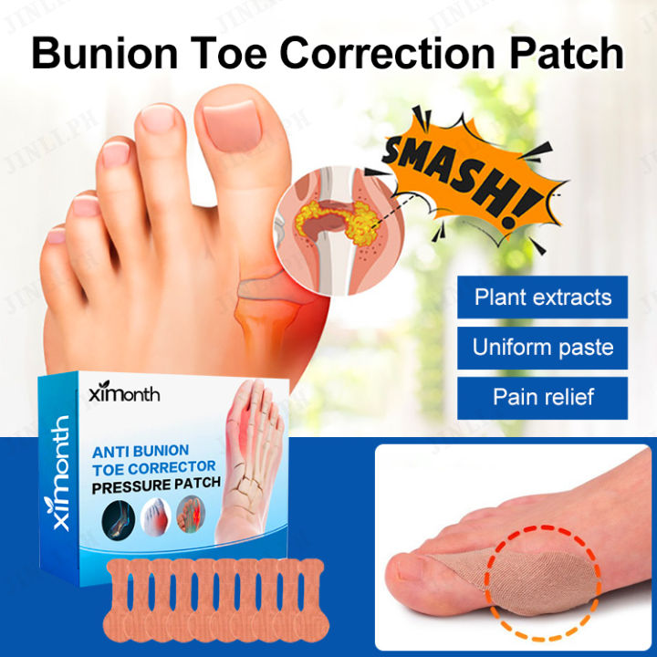 hpyshop Foot Care Sticker for Correcting Big Toe Deviation and Reducing ...