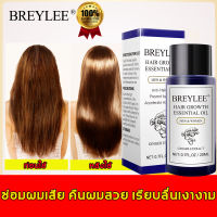 7วัน เห็นผลBREYLEE? เซรั่มปลูกผม ฟื้นฟูผมแห้งเสีย แก้ปัญหาผมร่วง ลดผมร่วง บำรุงรากผม ดูแลผม บำรุงผมแห้ง แตกปลาย ป้องกันผมร่วง น้ำยาปลูกผม ทรีทเมนต์สำหรับผม ป้องกันหัวล้าน นำ้ยาปลูกหนวด เซรั่มบำรุงผม น้ำปลูกผม ยาปลูกผมของแท้ ทรีนเมนบำรุงผมHair Growth Oil