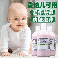 Xinlong calamine lotion 100ml skin disease baby dermatitis prickly heat pruritus external use