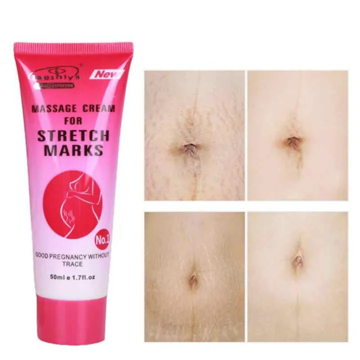 New Formulated Herbal Skin Dr Massage Cream for Stretch Marks Lazada PH