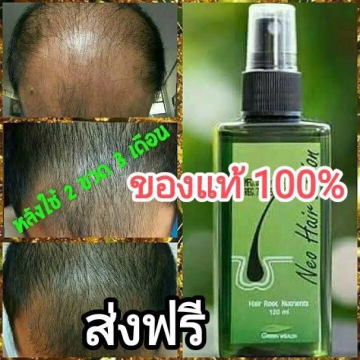 นีโอแฮร์โลชั่น-neo-hair-lotion-แบรนด์แท้-ส่งด่วน-1-ขวด-บรรจุ-120-ml-สเปรย์ปลูกผม-เซรั่มปลูกผม-ปลูกผม-ลดผมร่วง-น้ำยาปลูกผมหนา-น้ำยาปลูกผม-ปลูกผ