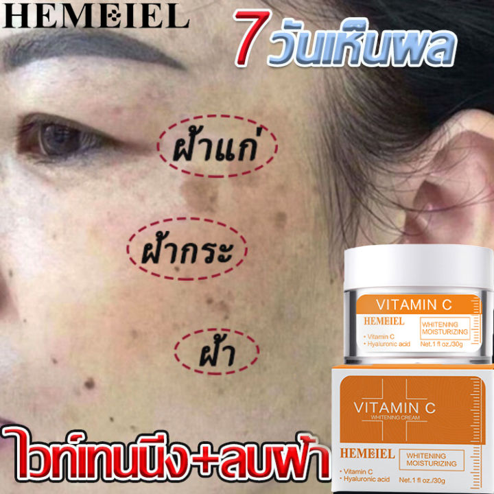 hemeiel-ครีมหน้าขาวใส-ครีมหน้าสด-ครีมรักษาฝ้า-ครีมหน้าขาว-30g