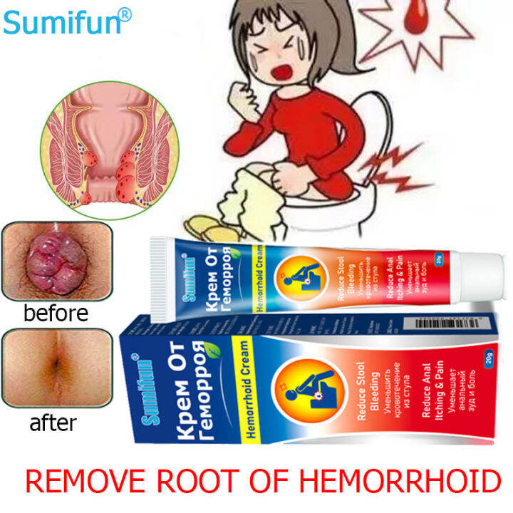 【Say goodbye to hemorrhoids】Sumifun Hemorrhoids Cream Original 20g