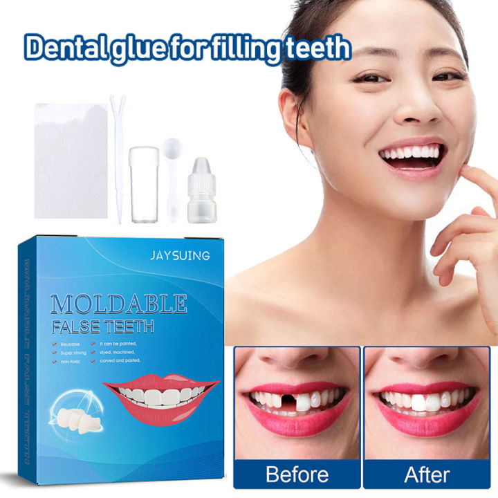 Temporary Tooth Repair Kit False Teeth Solid Glue Denture Missing ...