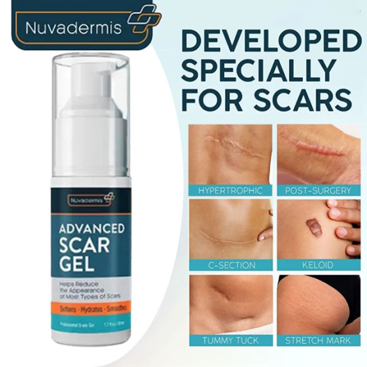 Nuvadermis Advanced Scar Removing Gel, Surgical Scar Acne Print Old ...