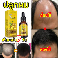 EELHOE เซรั่มปลูกผม 40ML ฟื้นฟูผมแห้งเสีย แก้ปัญหาผมร่วง ลดผมร่วง บำรุงรากผม ดูแลผม บำรุงผมแห้ง แตกปลาย ป้องกันผมร่วง( น้ำยาปลูกผม ทรีทเมนต์สำหรับผม ป้องกันหัวล้าน นำ้ยาปลูกหนวด เซรั่มบำรุงผม น้ำปลูกผม ยาปลูกผมของแท้ ยาปลูกผมผู้ชาย น้ำยาปลูกผมชาย)