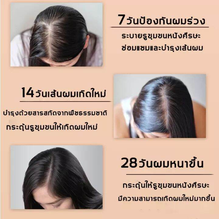 จัดส่งวันนั้น-แชมพูแก้ผมร่วง-แชมพูปลูกผมดก-แชมพูลดผมร่วง-แก้ผมร่วง-แชมพูปลูกผม-แชมพูสระผม-แชมพูขิงเพียว-แชมพูผมดก