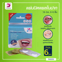 [[ 1กล่อง 6ชิ้น ]] แผ่นปิดแผลในปาก Time Oral Ulcer Patch (ขนาด 1.5 Cm.)