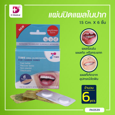 [[ 1กล่อง 6ชิ้น ]] แผ่นปิดแผลในปาก Time Oral Ulcer Patch (ขนาด 1.5 Cm.)