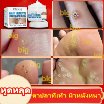 ปากกากำจัดไฝหูด ราคาถูก ซื้อออนไลน์ที่ - ก.ค. 2023 | Lazada.co.th ปากกากำจัดไฝหูด ราคาถูก ซื้อออนไลน์ที่ - ก.ค. 2023 | Lazada.Co.Th