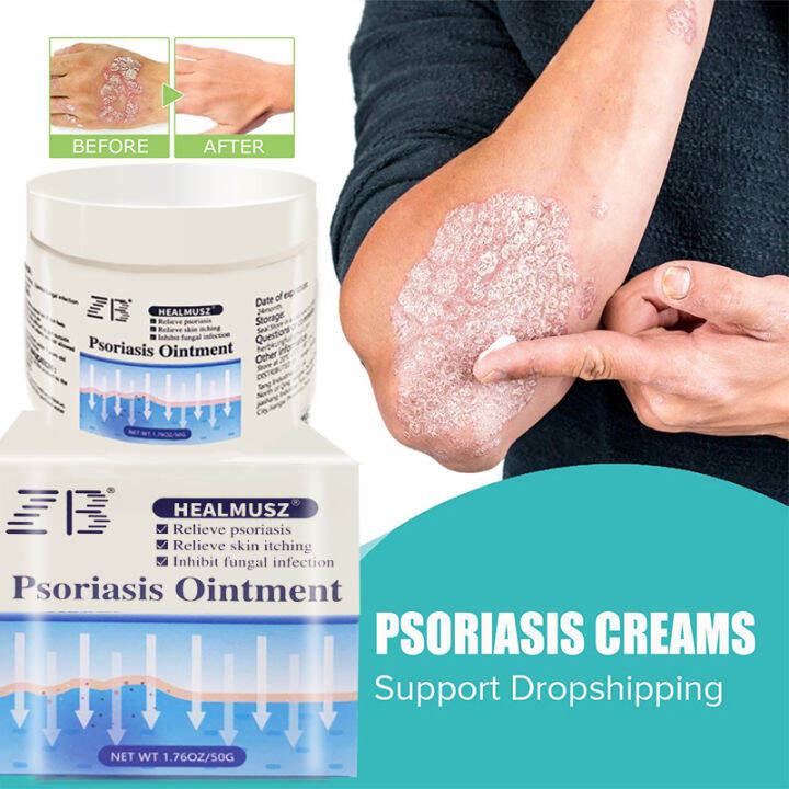 Seborrhoeic Dermatitis Eczema Psoriasis Treatment Ointment Effective