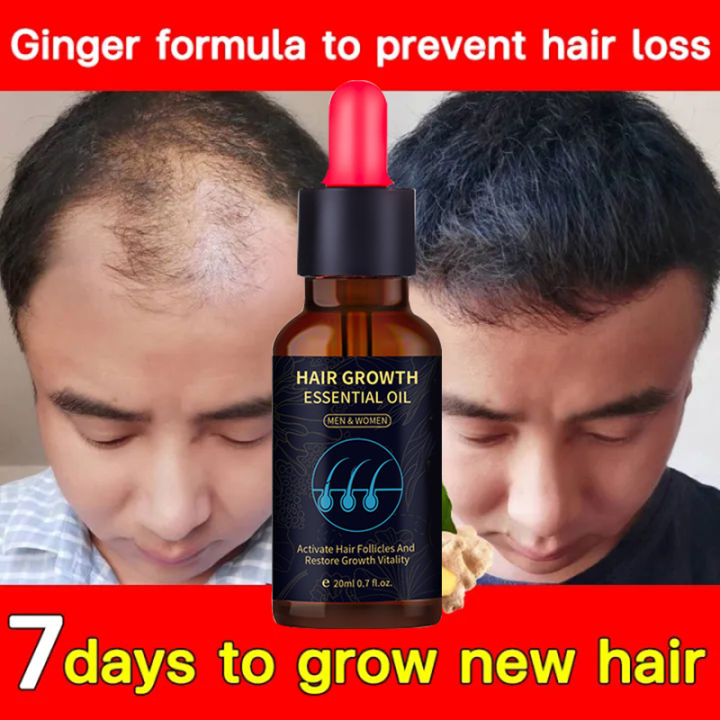 Minoxidil 5% Hair Grower Serum Original Hair Growth Essence Minoxidil 