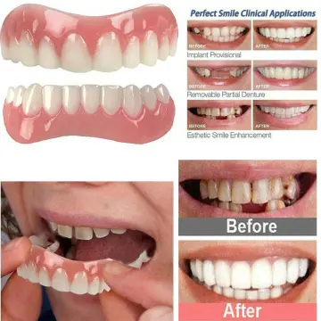 Resin False Teeth Solid Glue Temporary Tooth Repair Set Moldable