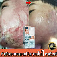 ฟื้นฟูผิวให้แข็งแรง ครีมลดรอยแผล 50g ยาทาแผลเป็น ยาทาแผลเป็นนูน ครีมลบรอยแผลเป็น ลบรอยแผลเป็น ครีมทาแผลเป็น แผลไฟไหม้ คีลอยด์ ซ่อมแซมผิวที่เสียหาย ครีมซ่อมแซม แผลผ่าตัด Scar cream