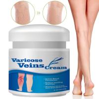 Cream Varicose Vein Remover &amp; Vein Care Lightening Cream Natural 20g Cream For Blood Veins Spider Veins Leg accepted