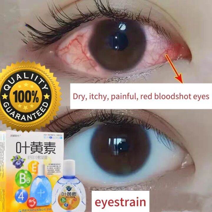 Xanthophyll Eye Drops Eye Cleaning Solution Eyes Care Relieve Blurred