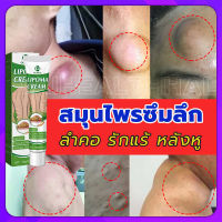 [ความนิยม] OUHOE ออกแบบ36ชนิดของไขมันใต้ผิวหนังกำจัดมวลก้อนไปยังถุงน้ำ Lymph Care Ointment สมุนไพรกำจัด ก้อนเนื้อใต้ผิวหนัง ก้อนซีสต์ ก้อนไขมัน ครีมทาซีส ก้อนไขมัน ครีมระบายน้ำเหลือง ครีมน้ำเหลืองแบบอ่อนโยน ครีมบวมคอ ต่อมน้ำเหลืองบริเวณรักแร้ พร้อมส่งทั