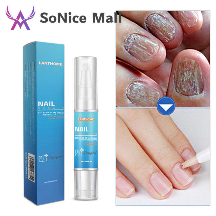 Nail Repair Pen Plant Essence Anti Fungal Nail Infection Toe Fungus
