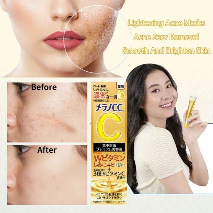 japan-vitamin-c-serum-for-face-pimple-marks-dark-spot-remover-rohto