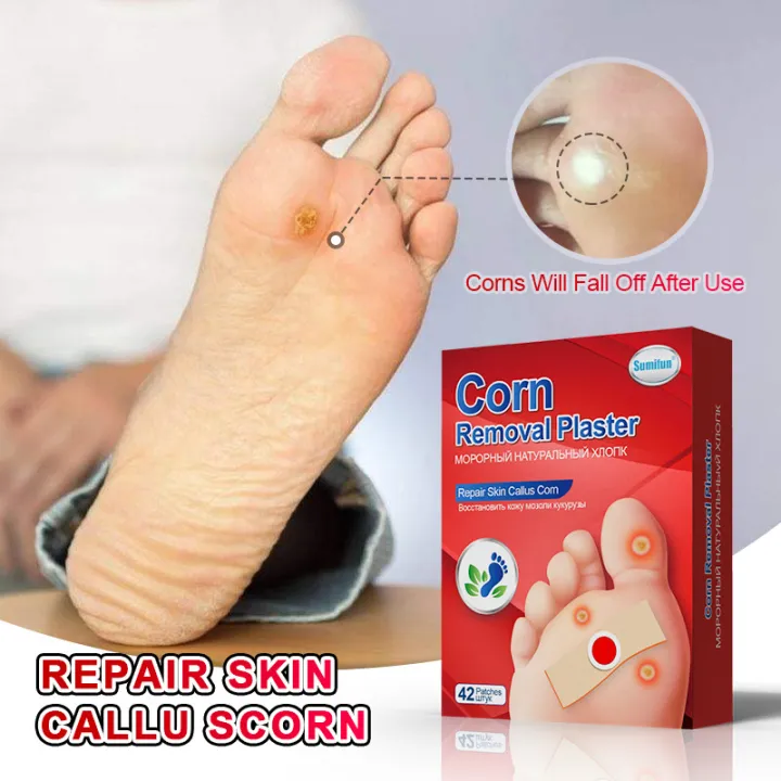 Corn Removal Plaster Feet Corns Warts Removal Patch Feet Corns Warts