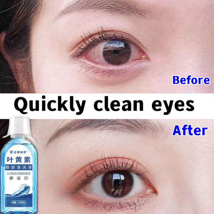 Japan EYEWASH eyewash eye lotion Ophthacare Eye Drops To Keep Your Eyes