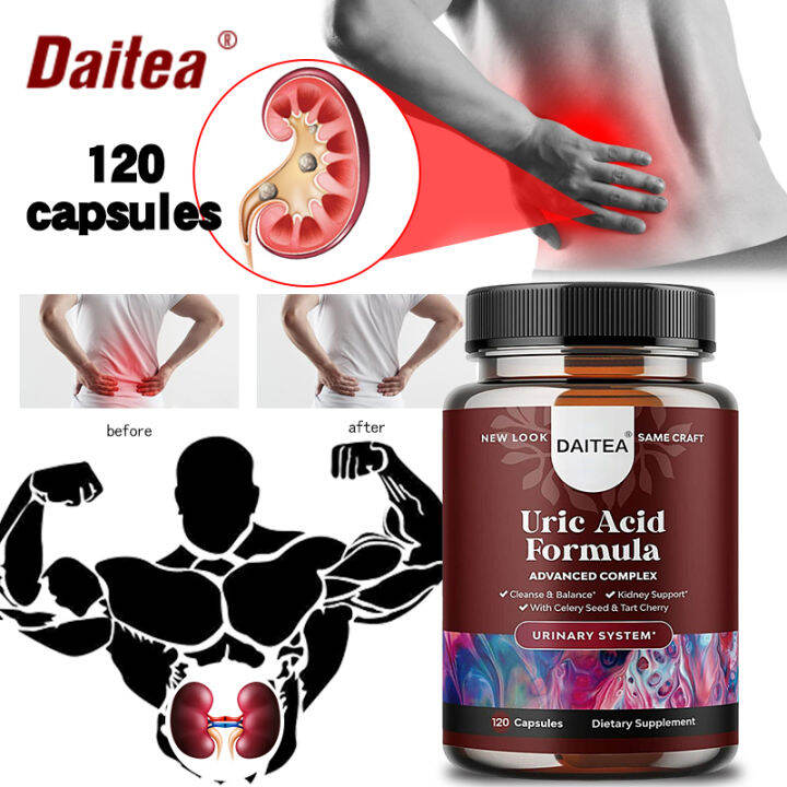 Uric Acid Kidney Support Vitamins for Men and Women Ease For Joint Pain Swelling & Stiffness