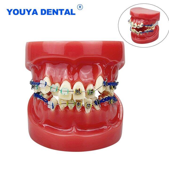 Dental Orthodontic Buccal Tubes Teeth Model Malocclusion Ortho Gum