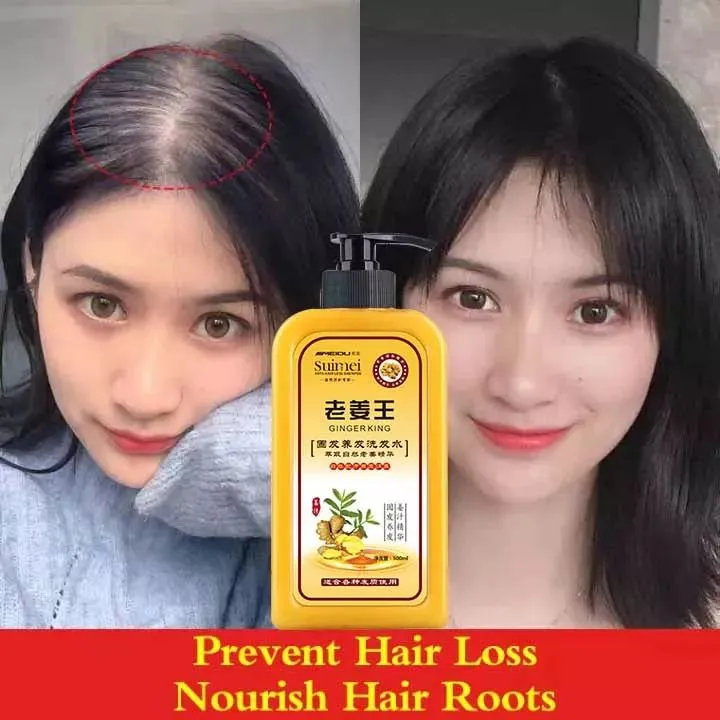 Pcs Ginger Hair Growth Intensive Spray For Men And Women Anti Hair Loss Products Fast Sunburst Hair Regrowth Essence 30ml Hair Loss Product Series AliExpress | 3pcs Hair Boost Ginger Cream, Anti-hair Pcs Ginger Hair Growth Intensive Spray For Men And Women Anti Hair Loss Products Fast Sunburst Hair Regrowth Essence 30ml Hair Loss Product Series AliExpress | 3pcs Hair Boost Ginger Cream, Anti-hair