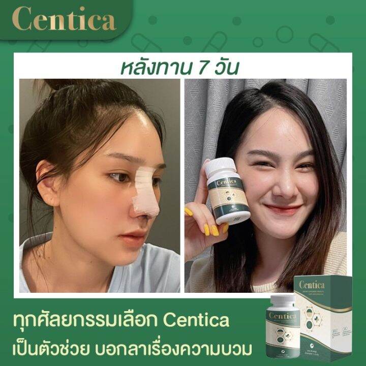 เซตสุดคุ้ม-centica-6-กระปุก-centica-wipes-2-แพ็ค-ยาลดบวม-ช้ำ-หลังศัลยกรรม-และทิชชู่เปียกทำความสะอาดหน้าหลังศัลยกรรม