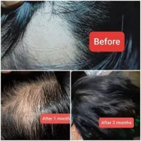Shop The Original Hair Syrup with great discounts and prices online - Aug 2022 | Lazada Philippines Shop The Original Hair Syrup with great discounts and prices online - Aug 2022 | Lazada Philippines
