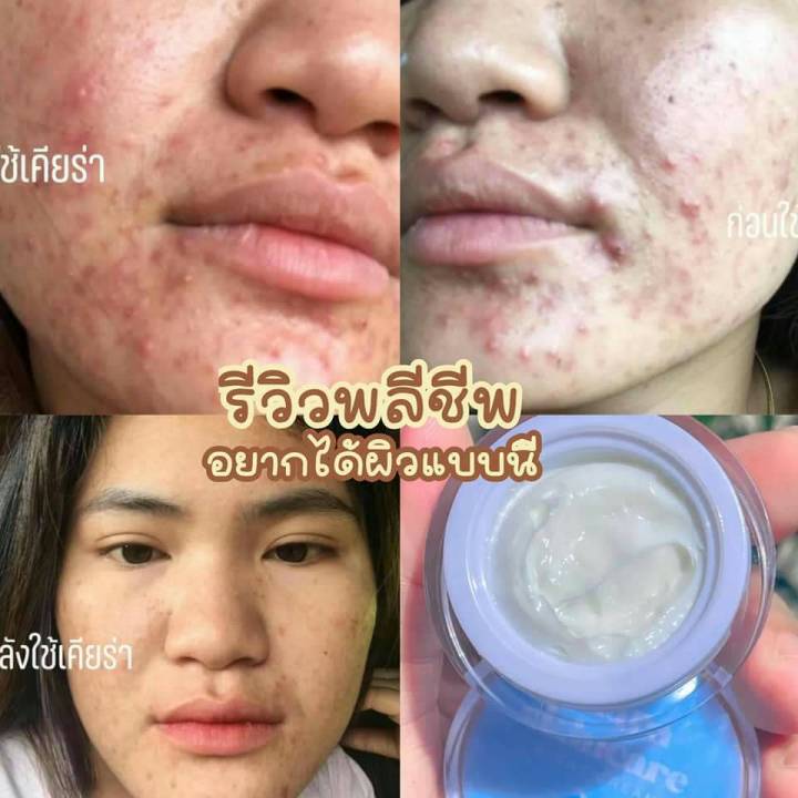 พร้อมส่ง-แพ็คาเกจใหม่-เคียร่า-ครีมหน้าใส-kiara-ลดสิว-ลดฝ้ากระ-จุดด่างดำจางไว3เท่า-หน้ากระจ่างใส