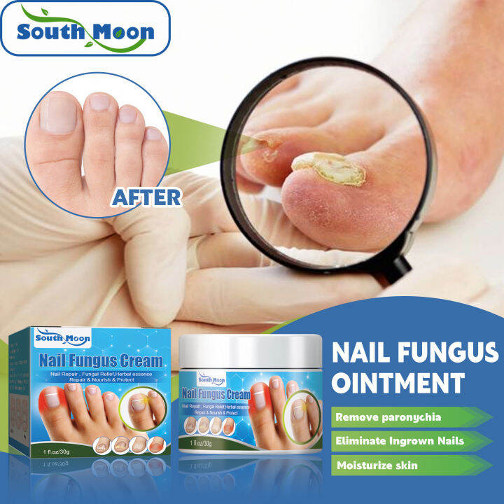 South Moon Nail and Foot Care Cream Removing Grey Nail Cleansing Soft ...