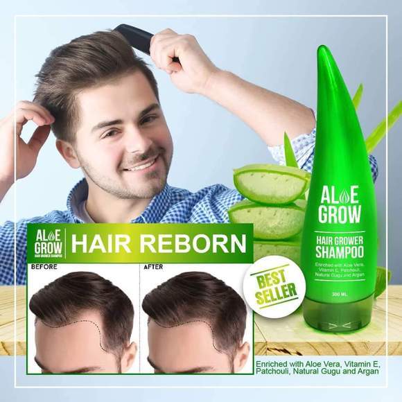 SE Hair Grower Shampoo 300ml for Dandruff Free and Healthy Hair | Lazada PH