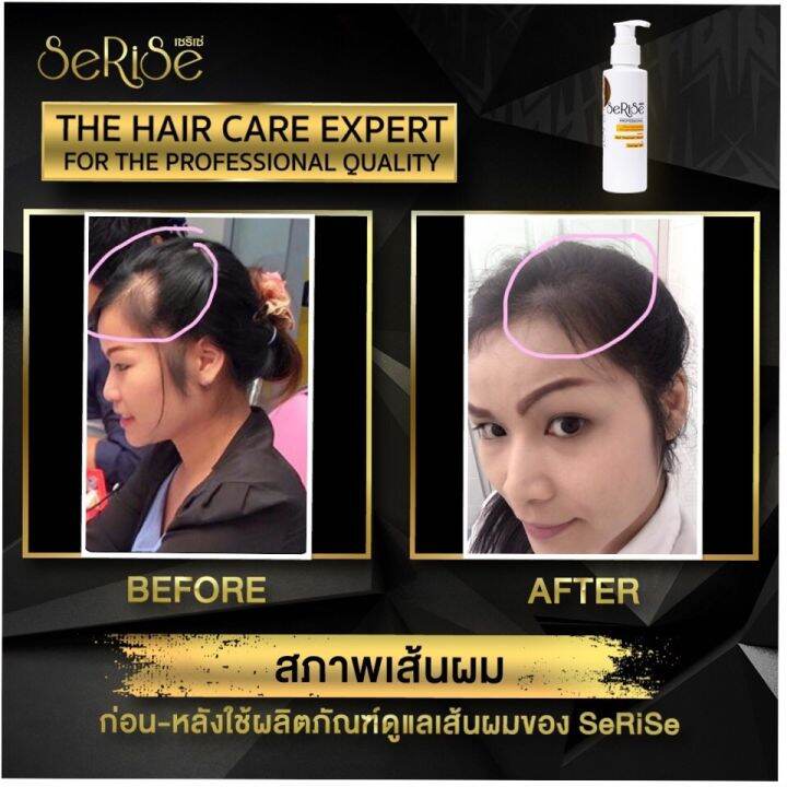 ใช้แล้วไม่เห็นผลยินดีคืน-2เท่า-serise-hair-serum-เซริเซ่-เซรั่มอาหารผม-เร่งผมยาว-พร้อมบำรุงผมเสีย-อาหารผม-120-ml