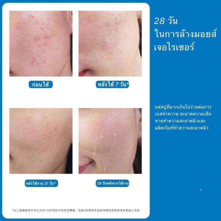 โฟมล้างหน้า-สำหรับผู้หญิง-ขจัดความมันส่วนเกิน-ได้อย่างหมดจรด-กรดอะมิโนโฟม