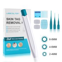 3 In 1 Auto Skin Tag Removal Kit Band Non Toxic Face Care Painless Mole Wart Remover Micro 2-8Mm Meat Nevus Tool Home Use Adult