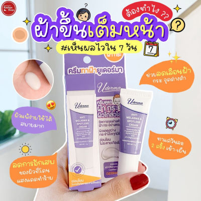 Kimhanshops Uderma Anti-Melasma &amp; Spotless Cream