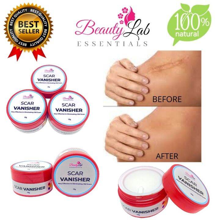 DC PREMIUM | Scar Removal Cream (10g) | Beauty Essentials | Scar ...