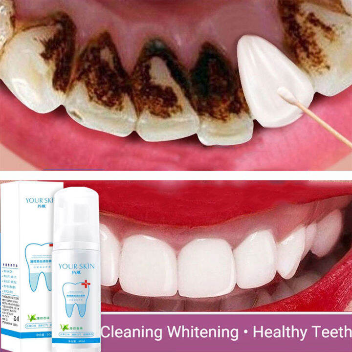 Teeth Whitening Mousse Toothpaste Oral Hygiene Remove Stains Plaque